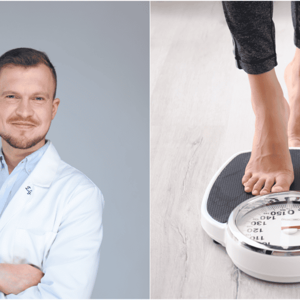 Dietologas aiškina, kas yra sėkmingas svorio metimas ir nutukimo gydymas